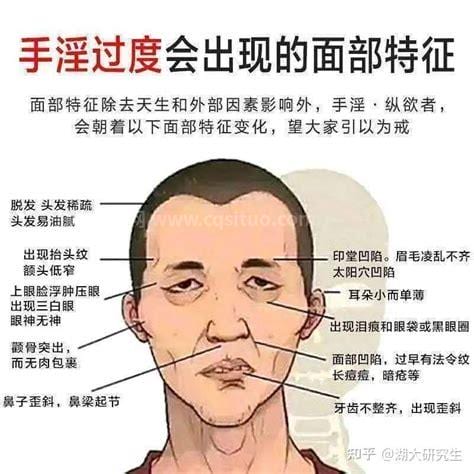 手淫过度会导致什么