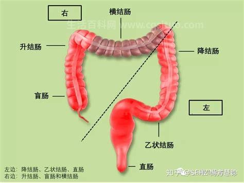 大肠癌好发于哪个部位