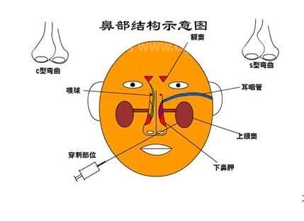 鼻甲是哪个部位