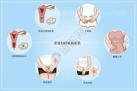 妇科病有哪些