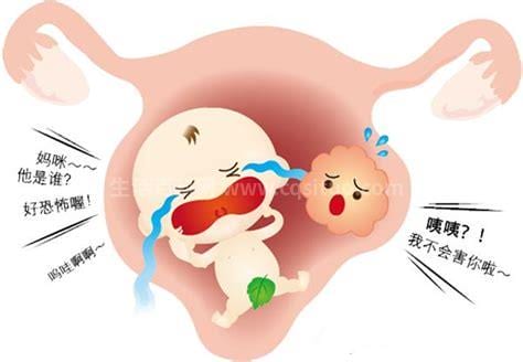 宫颈肥大的原因和治疗方法