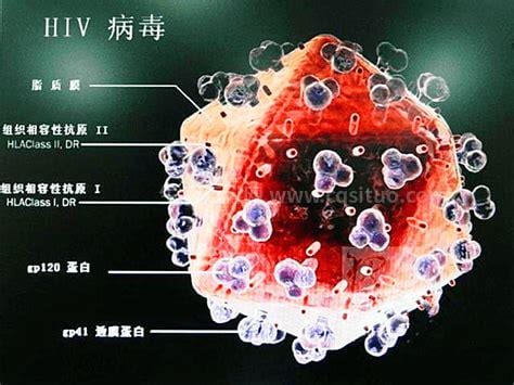 什么是hiv病毒