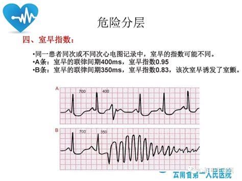 频发性室性早搏的危害