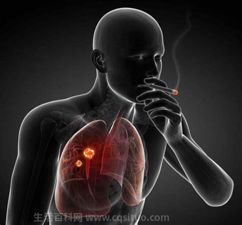 吸烟会导致肿瘤吗？