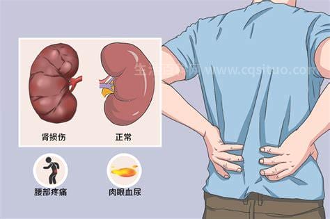 肾挫伤的并发症有哪些