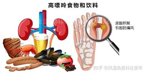 痛风饮食注意什么