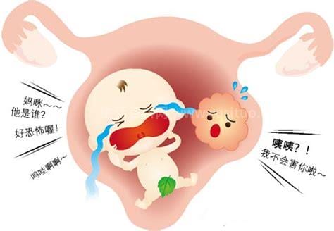 宫颈肥大的原因和治疗方法