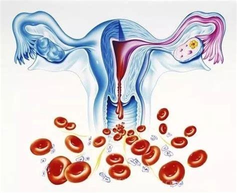 子宫异常出血是什么原因