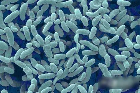 大肠杆菌是兼性厌氧菌吗