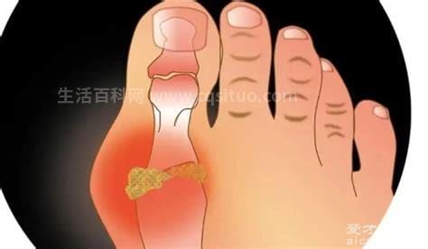大脚趾疼痛是什么原因