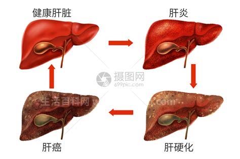 乙肝的早期症状