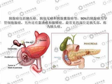 胃炎和胰腺炎的区别