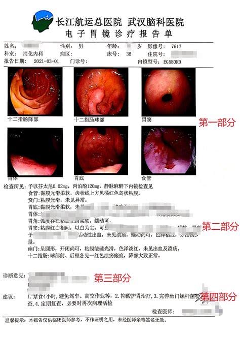 检查胃挂什么科