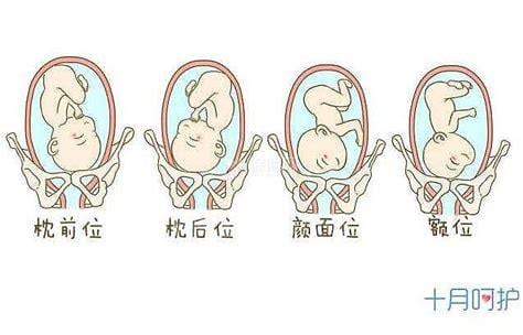 胎位ROA是什么位置？