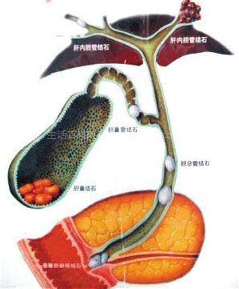 ercp是什么检查