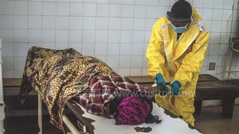 埃博拉出血热的症状有哪些