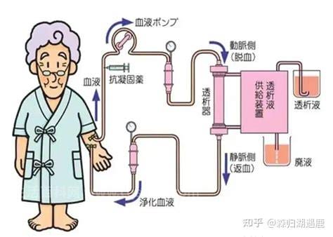 血液透析有什么作用