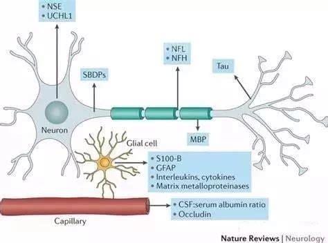 神经元特异烯醇化酶偏高原因