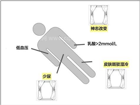 休克是什么引起的