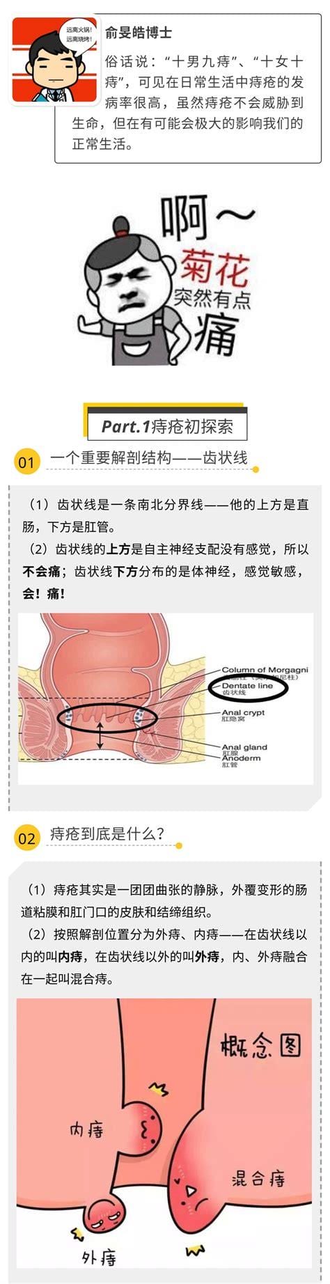 痔疮的分期