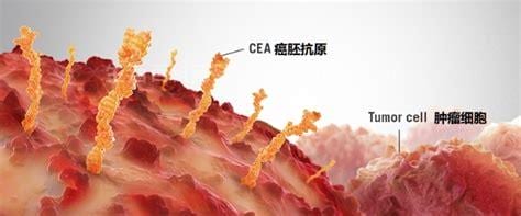 癌胚抗原cea是什么意思