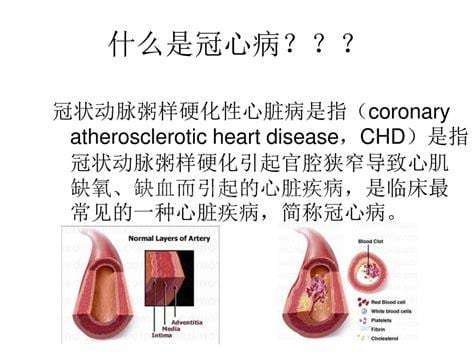 CHD是什么病的简称