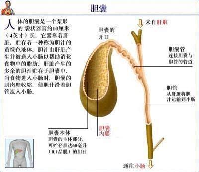 胆囊炎的症状及治疗