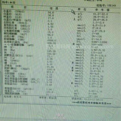 术前四项检查是什么