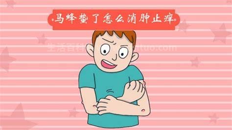 蜂子蛰了怎样消肿止痒