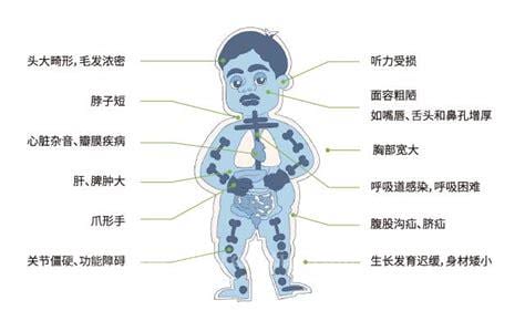 糖宝宝是什么病