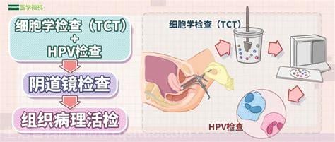 ctc检查是什么检查