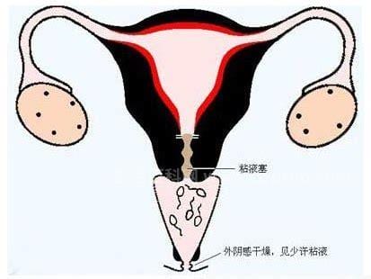 重度宫颈糜烂的症状是什么