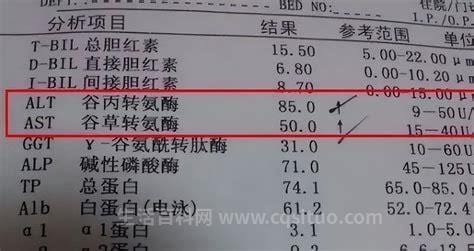 转氨酶高多少不能入职