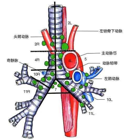 纵隔淋巴结肿大是什么意思