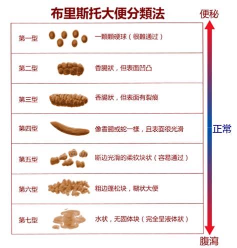 大便干燥吃什么好