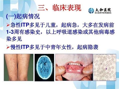 itp是什么病的简称