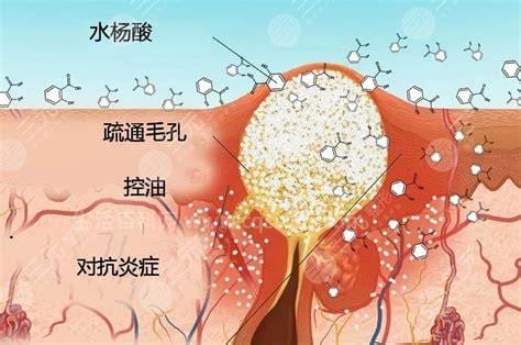 水杨酸的作用和危害