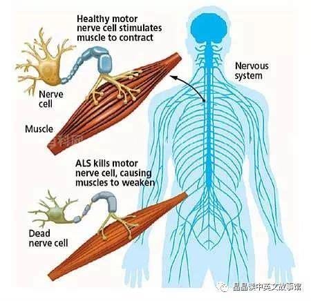 什么是脊髓侧索硬化症