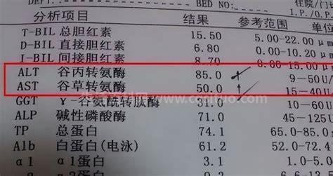 谷草转氨酶正常值