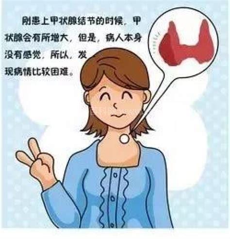 女性甲状腺的早期症状