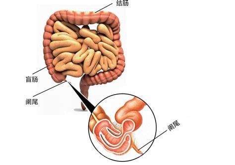 阑尾炎保守治疗多久