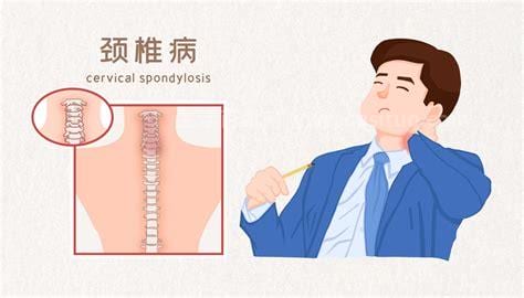 颈椎病平常如何保健