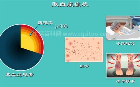 败血症是什么细菌引起的