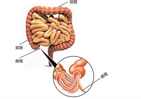 急性阑尾炎穿孔怎么治