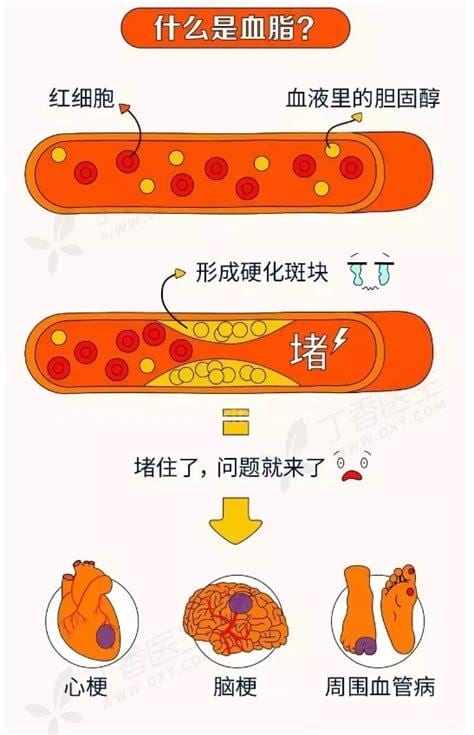 总胆固醇高说明什么