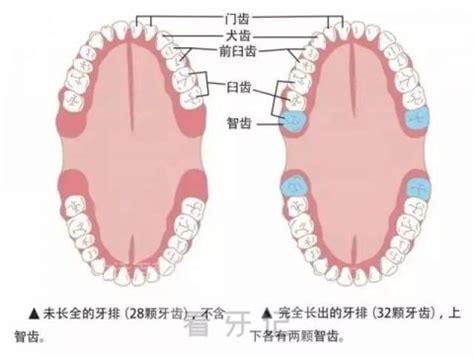 什么是智齿