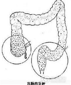 盲肠肉芽肿是由哪些原因导致的