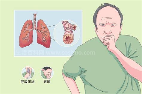 支气管痉挛是怎么回事