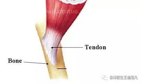 什么是肌腱损伤