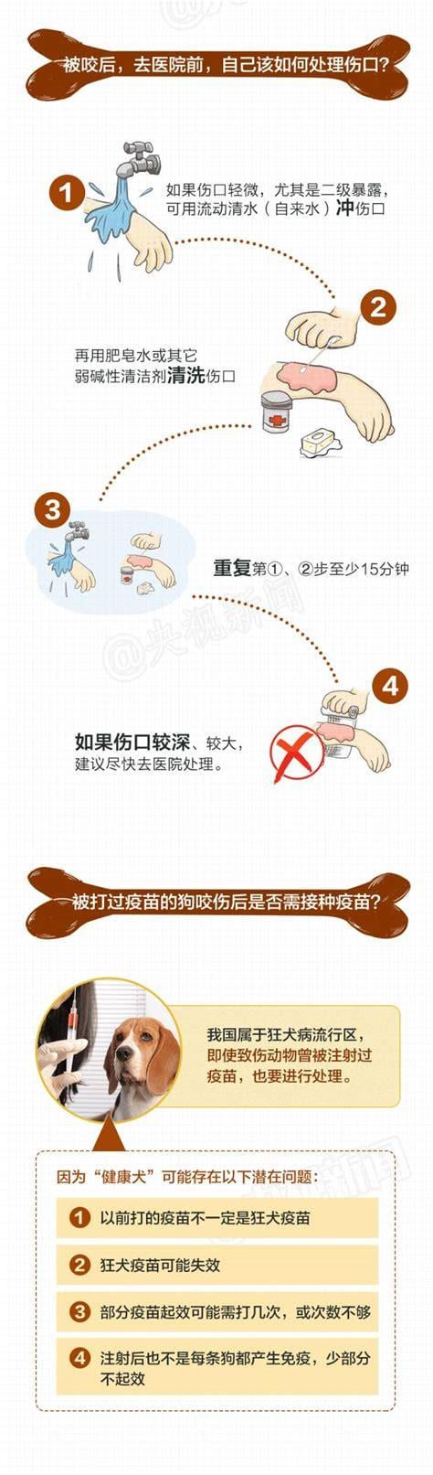 狂犬病的预防措施是什么